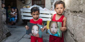 Prince and Charles following cleft lip and palate surgery carried out by doctors trained by Smile Train.